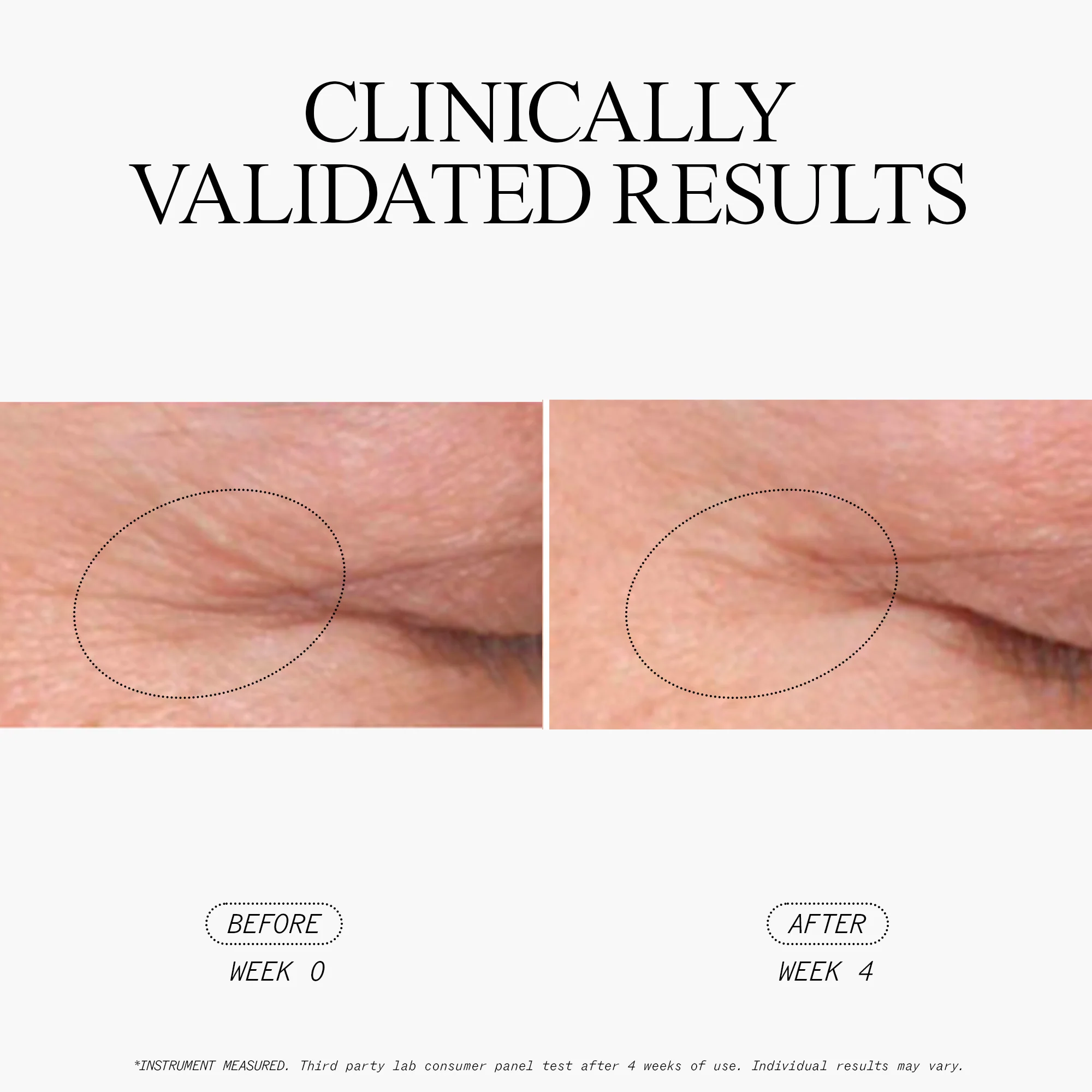 Anti-Wrinkle Retinol Overnight Serum - Image 4