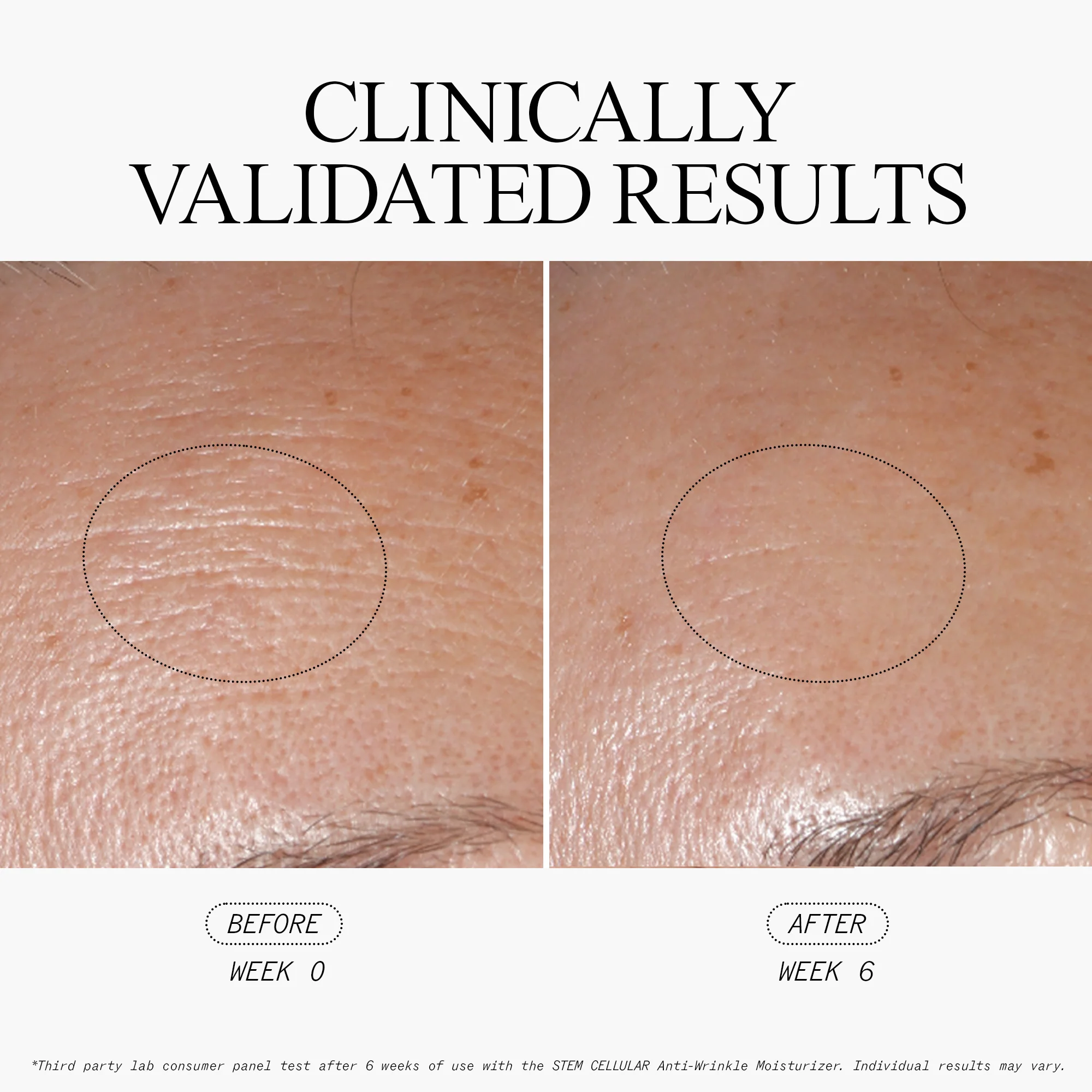Anti-Wrinkle Moisturizer - Image 4