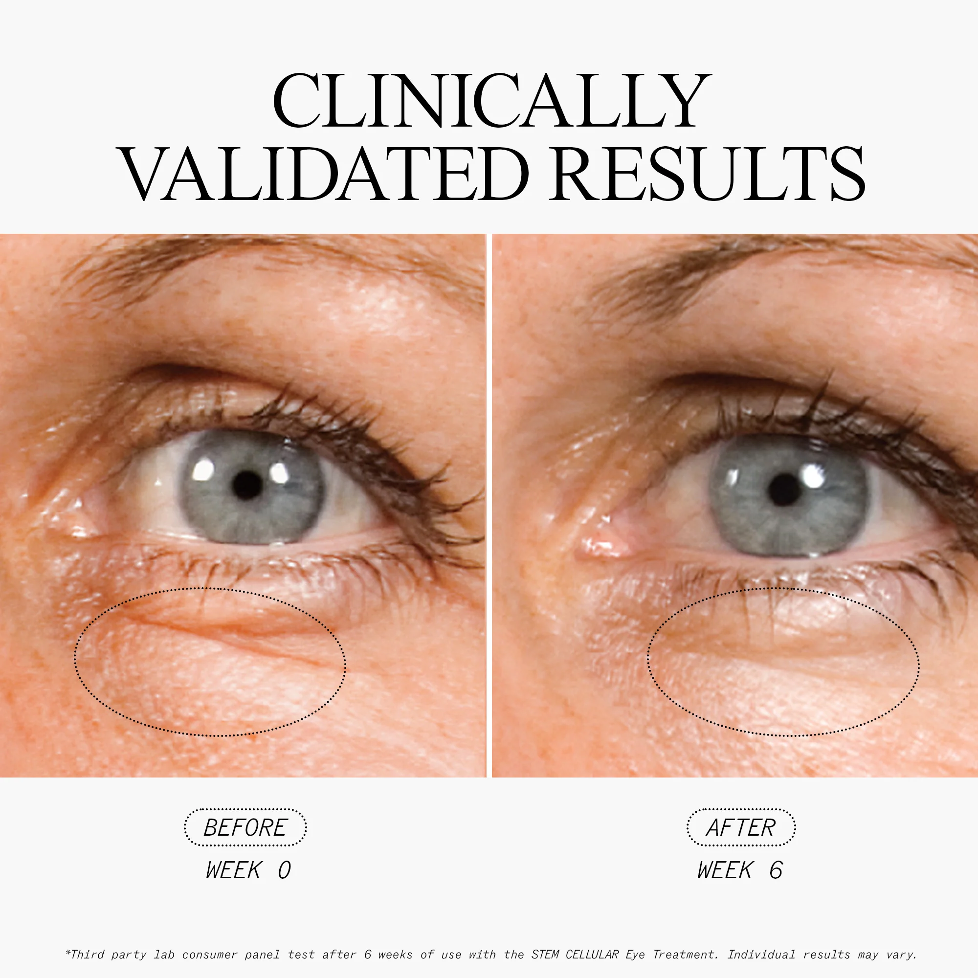 Anti-Wrinkle Eye Treatment - Image 3