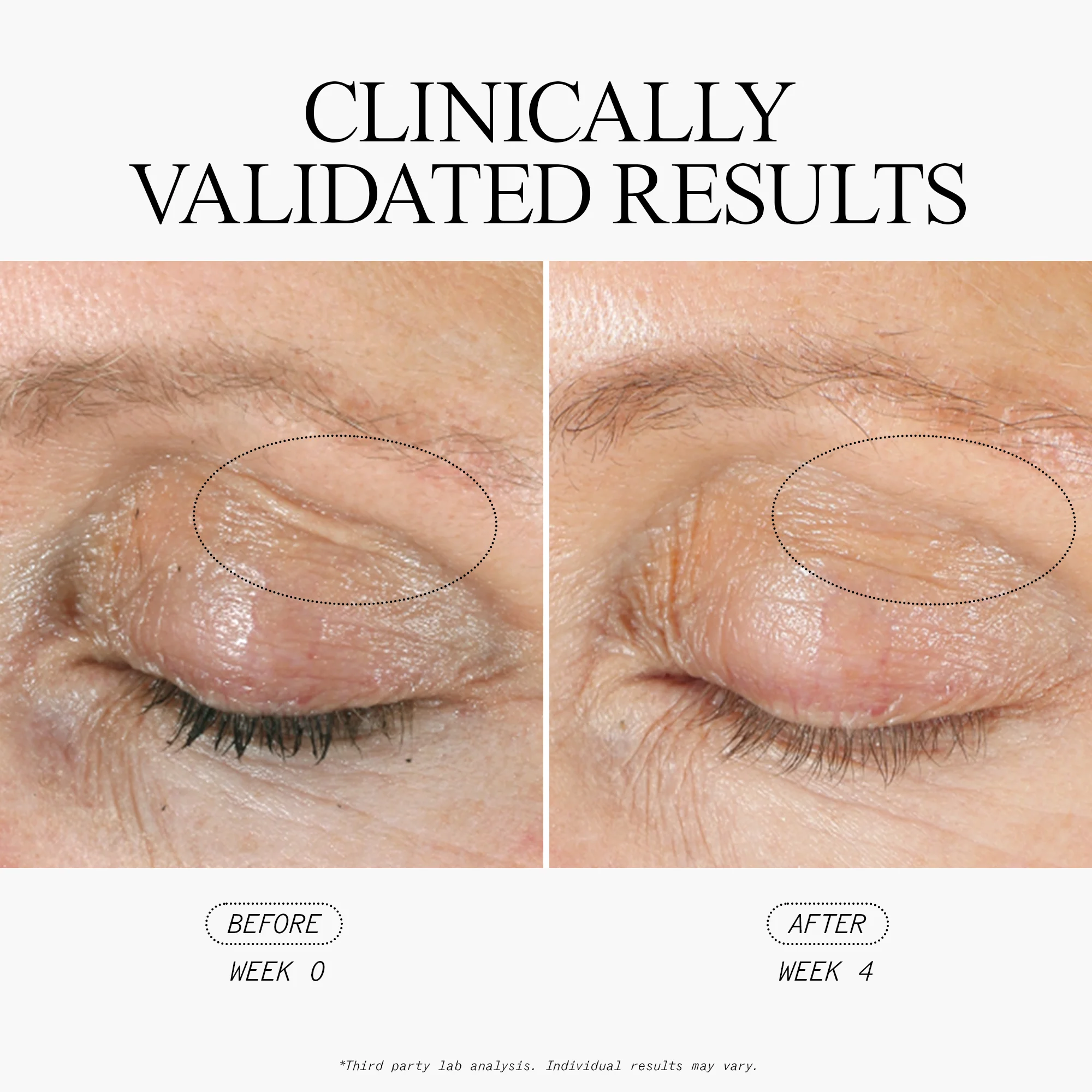 Youth Renew Hyaluronic Acid Serum - Image 3